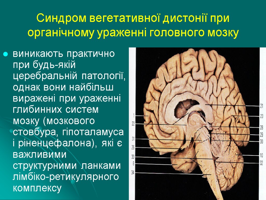 Синдром вегетативної дистонії при органічному ураженні головного мозку виникають практично при будь-якій церебральній патології,